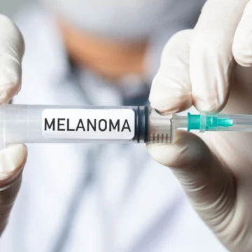 New mRNA Vaccine Reduces Risk of Melanoma Recurrence by Over 40 Percent